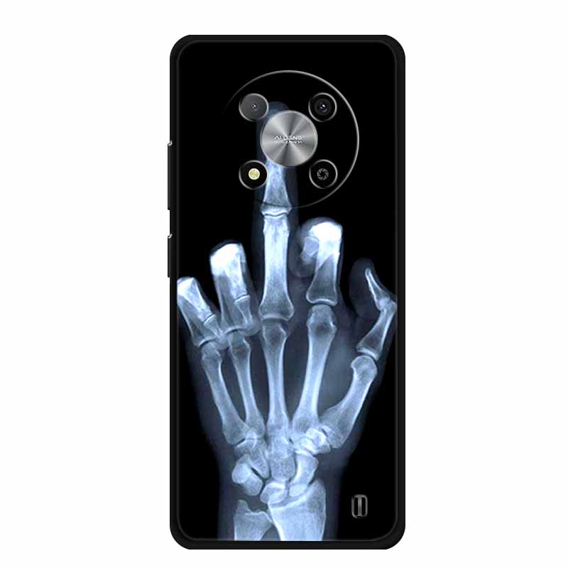 Capa Para ZTE Blade A73 5G Animais Silicone Macio TPU Capa de Telefone Para ZTE Blade A73 5G 7160N Capas Lobo Fruta Estampada Fofa Coque