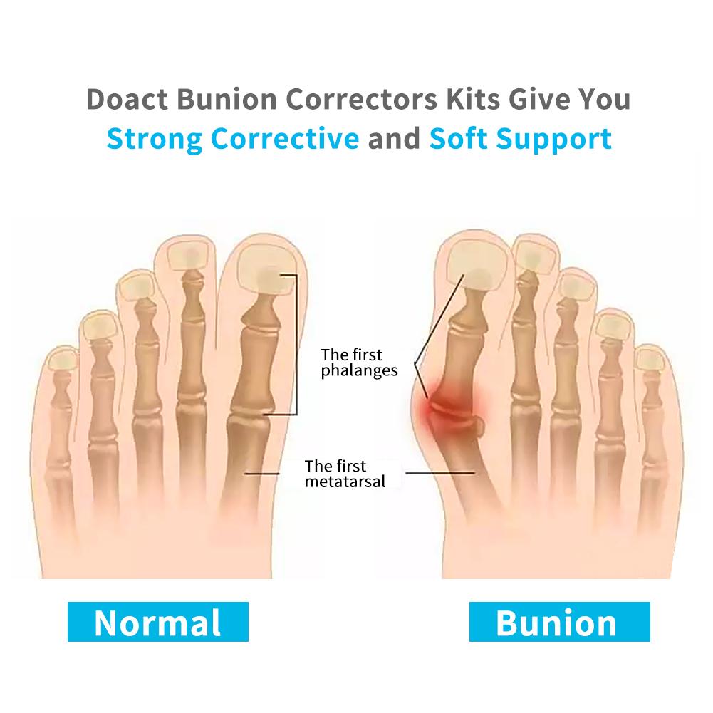 1 Paar Bunion Toe Straightener Corrector 3 Paar Silikon Gel Toe Separator(S)