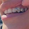 Unisex Dental Grills Jewelry Vintage Silver Gold Teeth Caps With Stars Motif Sturdy Brass Material Fashion Accessories