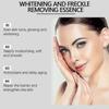 Vitamin C Spot Correcting Serum, Brightening & Anti-Aging Face Serum, Dark Spot Remover for Hyperpigmentation, Freckles & Acne Scars, 30ml
