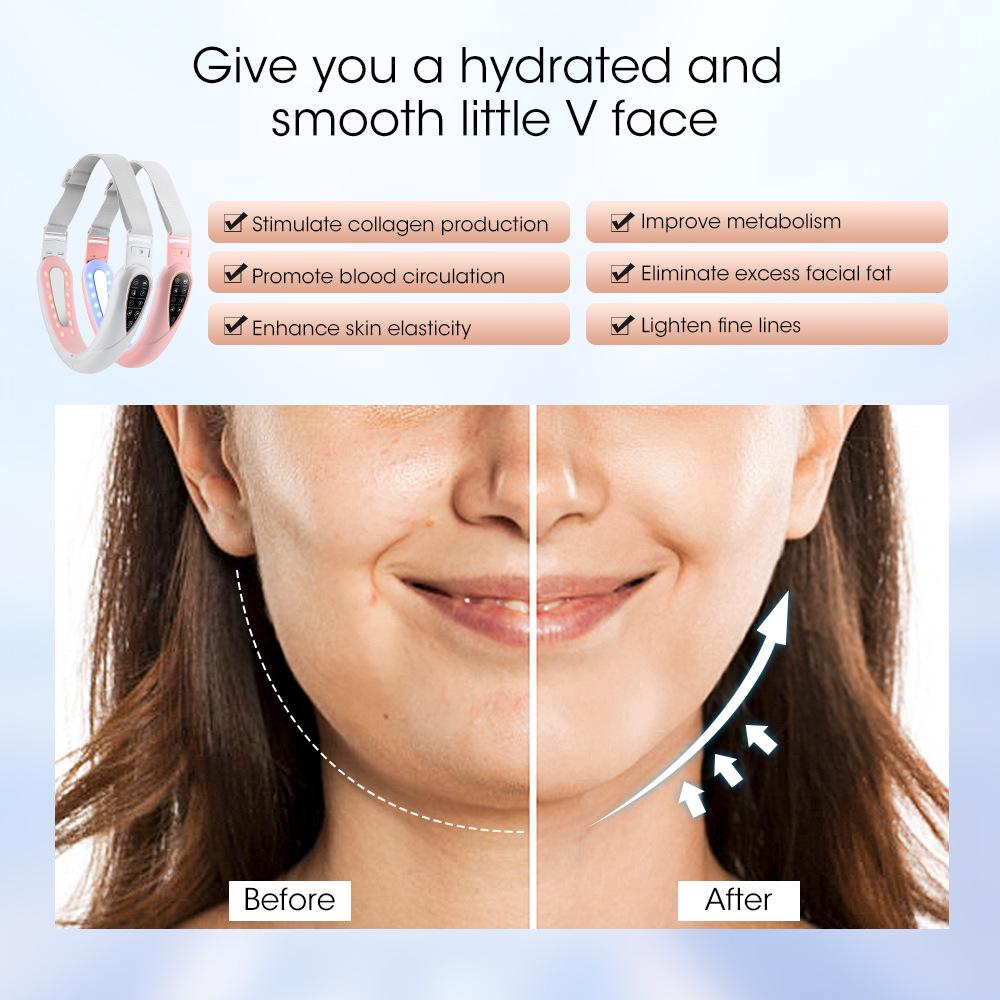 EMS Vibration V-Face Device: Remote-Controlled Beauty Massager with 5 Color Light Modes for Facial Care