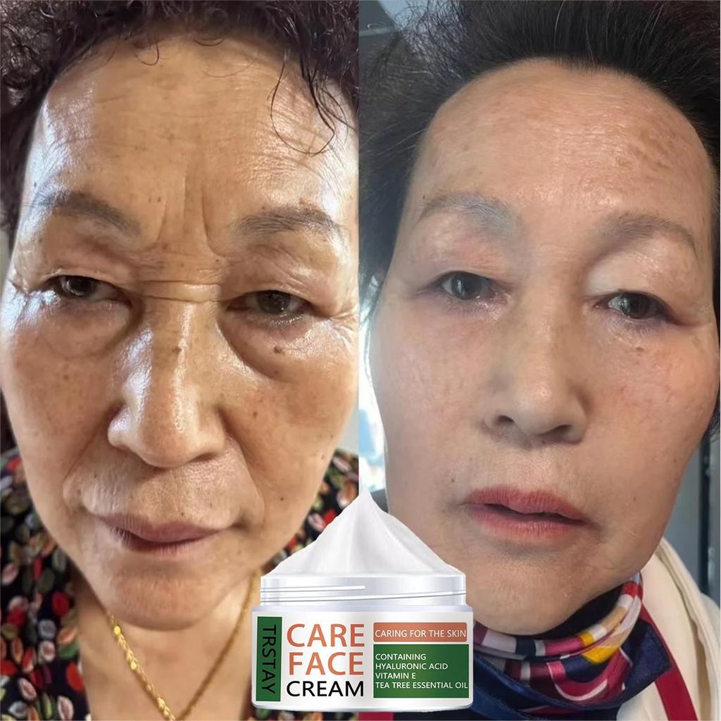 Jemný a nedráždivý rozjasňující krém proti vráskám vyhlazuje vrásky, vypíná jemné linky a zanechává pleť jemnou a hebkou.