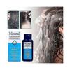 Nizoral Anti Dandruff Shampoo 7 Fl Oz 200ml EXP