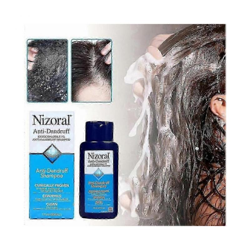 Nizoral Anti Dandruff Shampoo 7 Fl Oz 200ml EXP