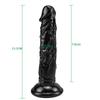 RUNYU Gerçekçi Dildo Cilt Hissi Kadınlar için Seks Oyuncakları Vantuzlu Siyah Penis Kadın Mastürbatörü Anal Seks Ürünü