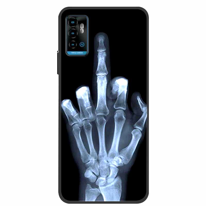 For ZTE Blade A71 Case Shockproof Soft silicone TPU Back Cover For ZTE BladeA71 Phone Cases for ZTE Blade A 71 2021 Cute Cartoon