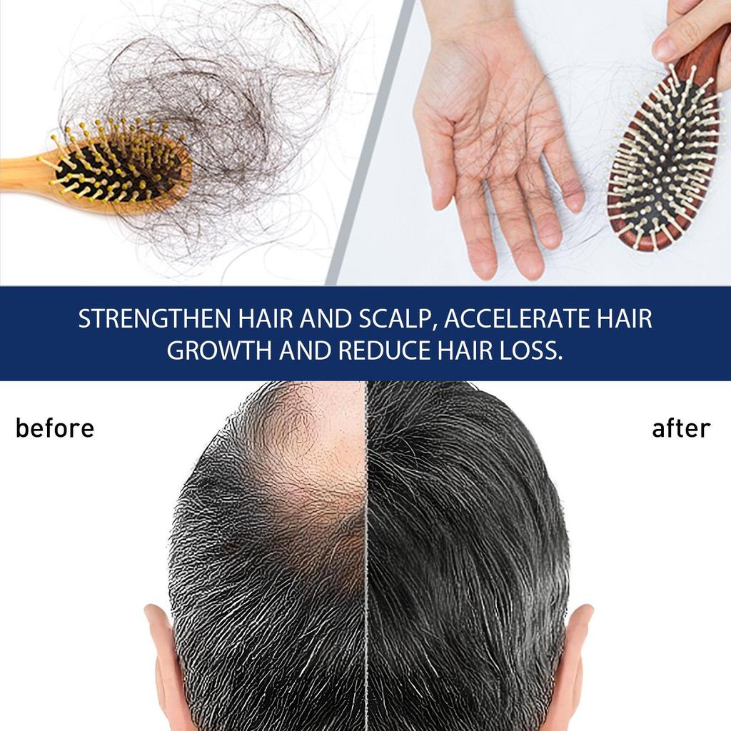 Cream Anti Hair Loss Products Fast Growing Prevent Dry Frizz Damaged Repair Treatment Scalp Beard Care Men Women 20g