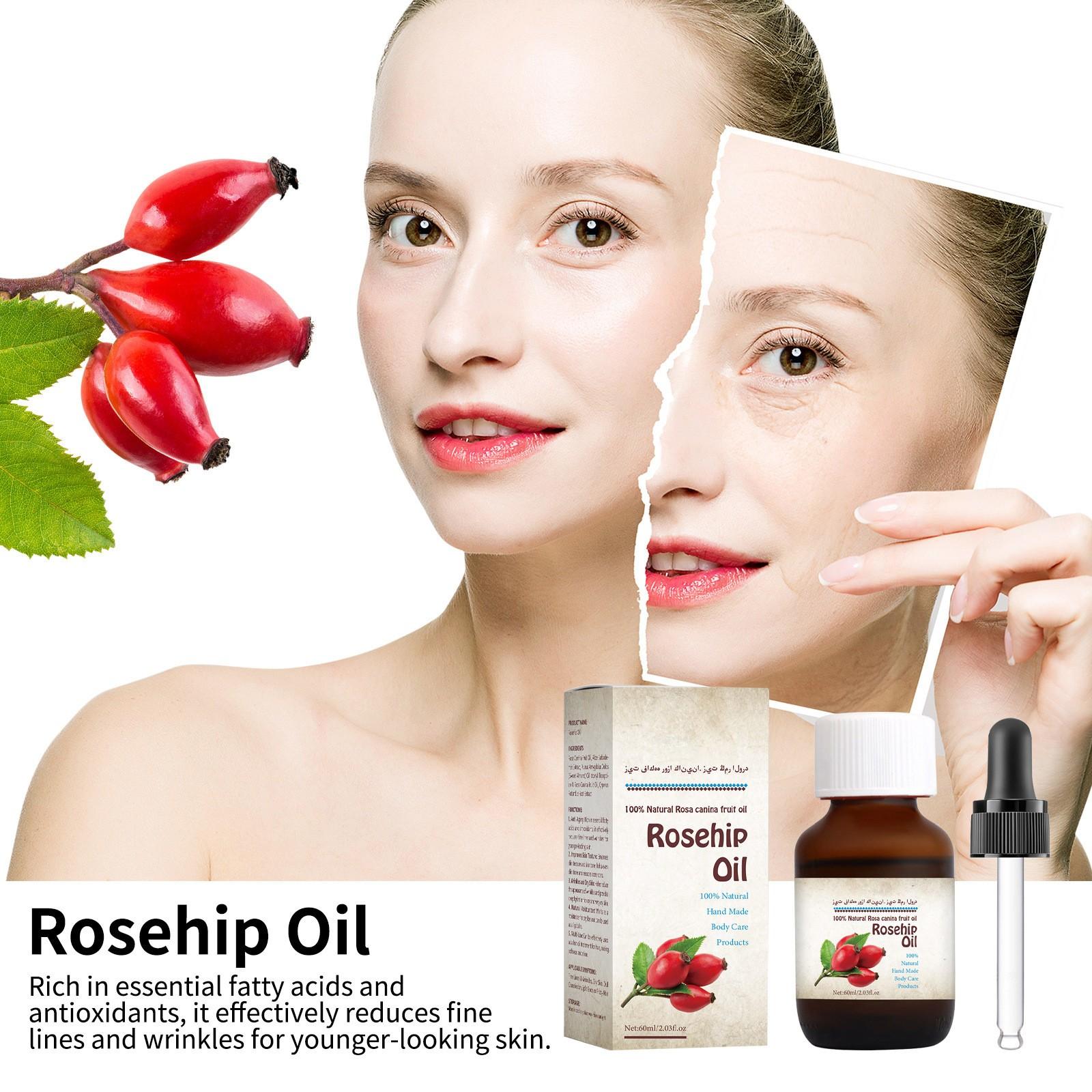 

Масло шиповника подходит для лица и тела натуральное веганское масло семян шиповника против старения и морщин 60 мл белый