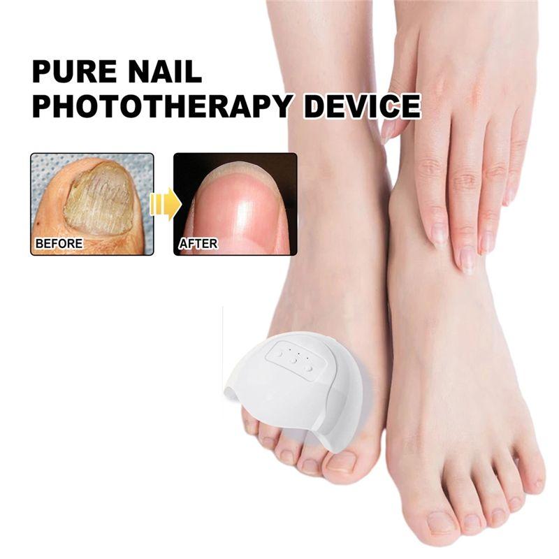 A04V Lasers For Nail Fungus Treatment Device Onychomycosis Cleaning Foot Repair Fungi Fungal For Nails Removal Anti Mushroom