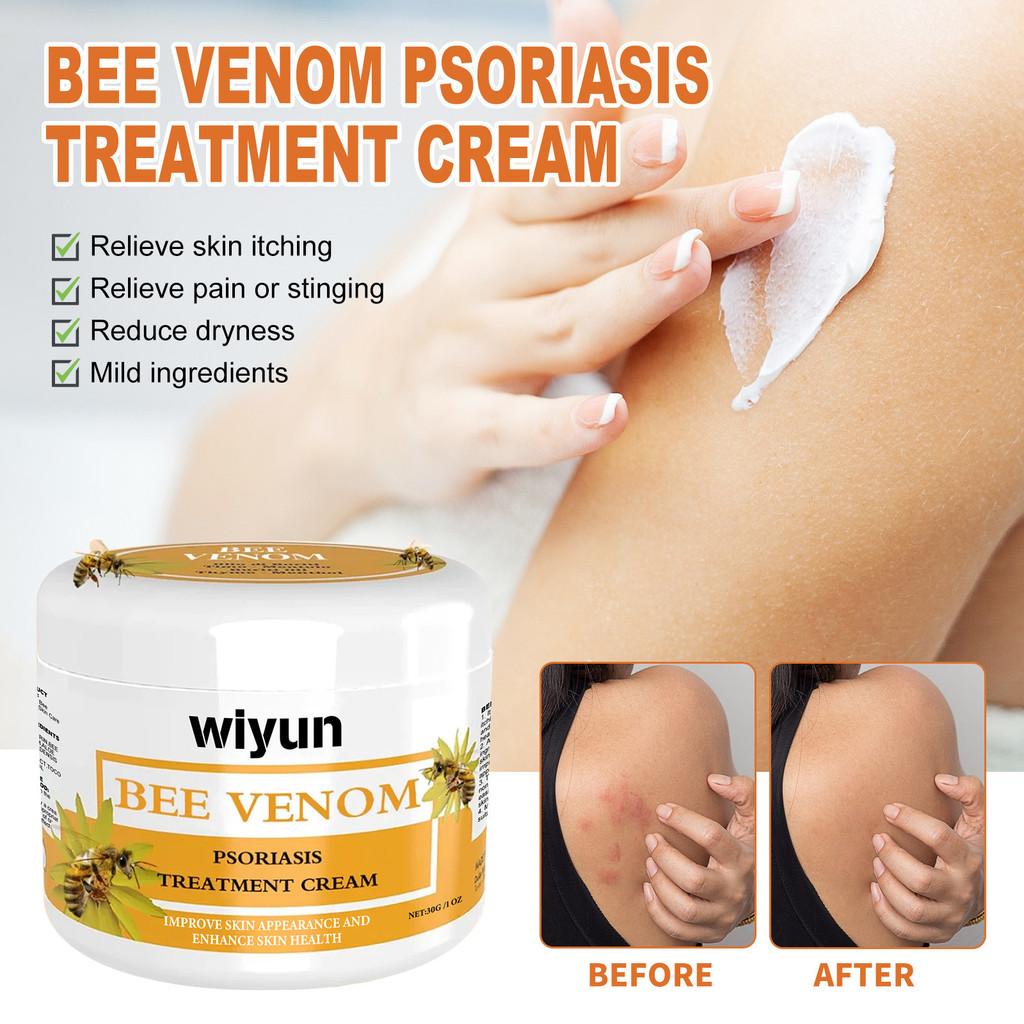 Premium Wiyun Bee Venom Skin Cream For Repairing Dry And Itchy Skin With Soothing Hydration