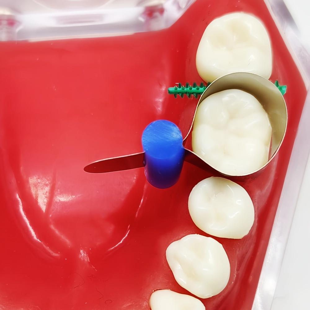 Dental Teeth Whitening Retainer Ring Metal Matrice Dental Bands Retainerless Automatrix Metal Matrices with Locker