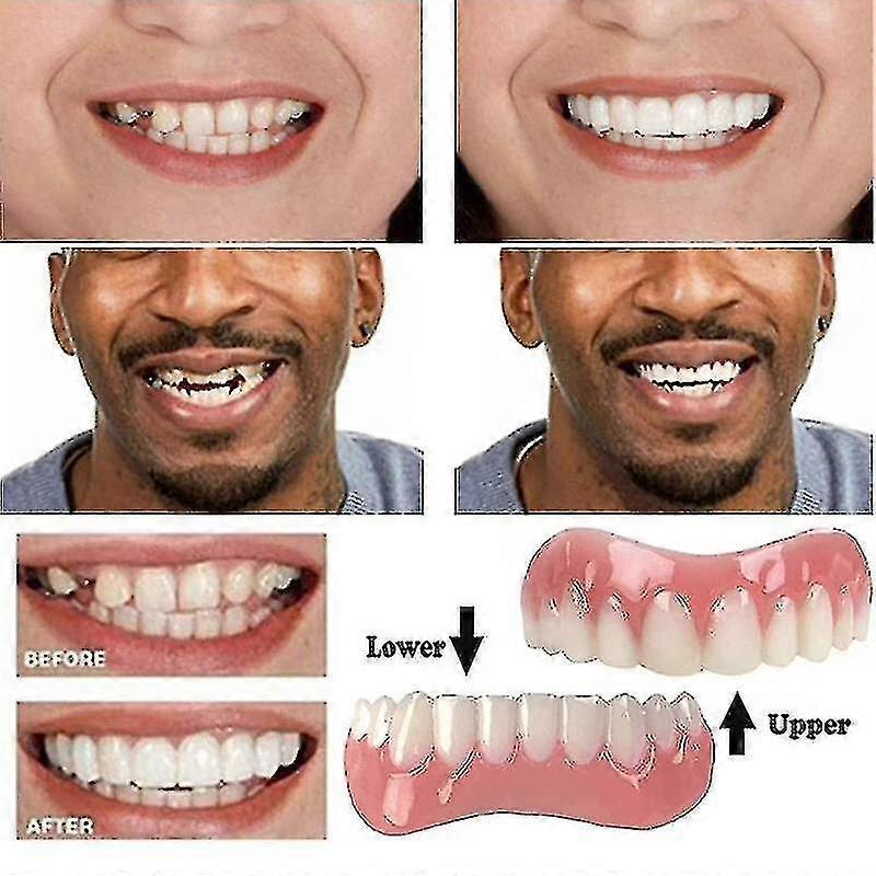 Extra Thin Fake Bright White Tooth Veneers Silicone Soft Safe Adhesive Denture Hide Shade Braces Comfortable Teeth Orthodontic-dwdz