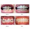 Průhledný měkký elastický chránič zubů z TPE: Chránič zubů proti skřípání & Přenosný ortodontický rovnátko.