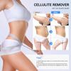 Sens for Improvement In The Appearance of Cellulite Device Cellulite Massager Radio Frequency, White