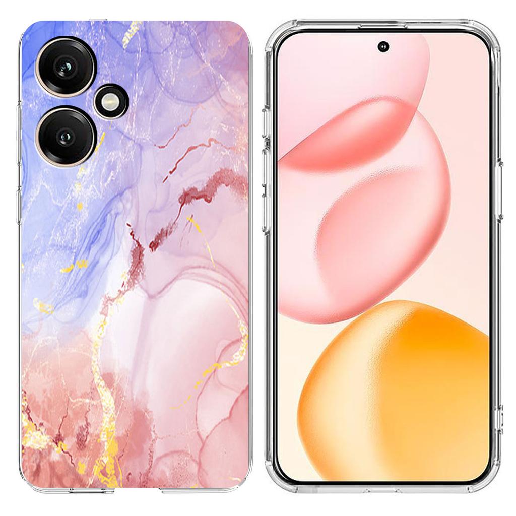 For Honor 400 5G (Global) Case Marble Pattern Printing Soft TPU Phone Cover
