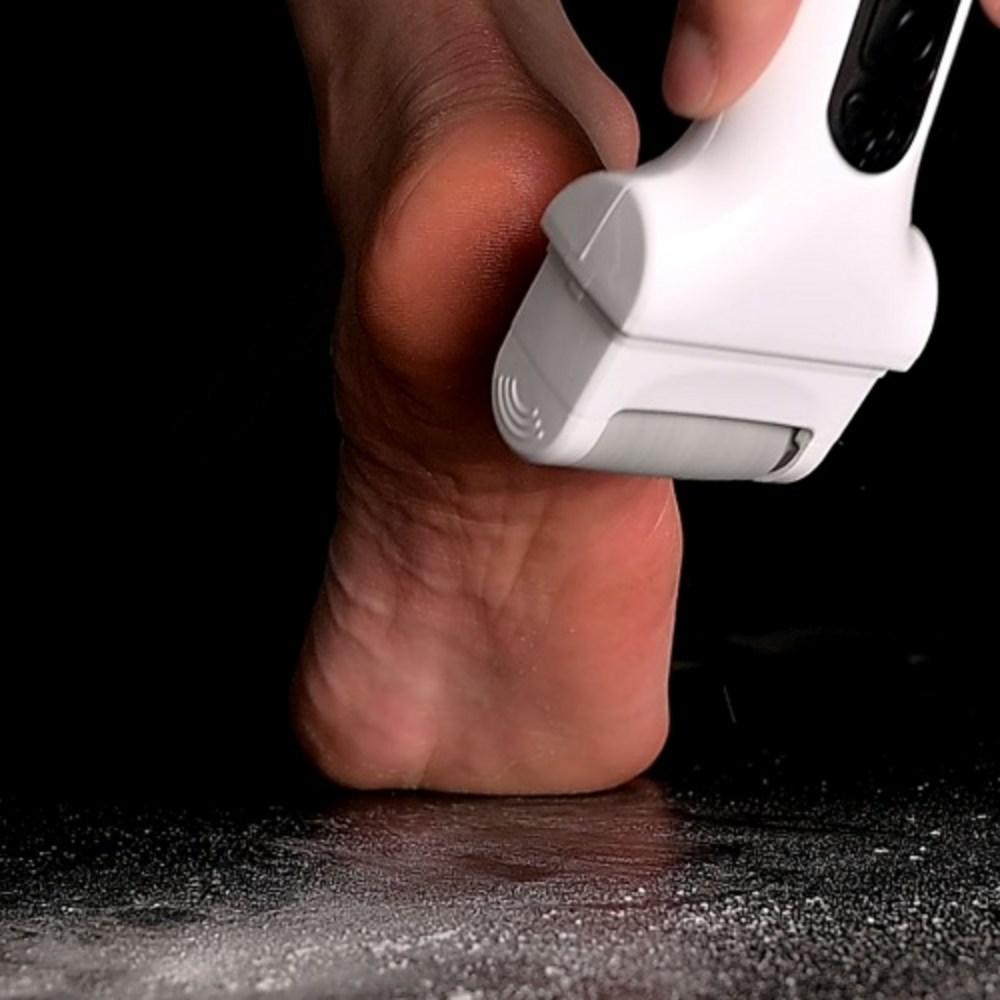 Cresome Electric USB Wireless Foot Callus Remover, White, CRE-F001