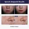 TOSOWOONG - Real Spicule Ampoule