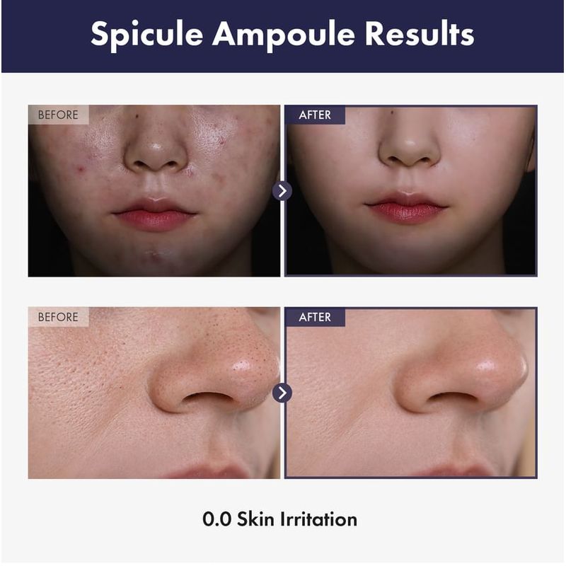 TOSOWOONG - Real Spicule Ampoule