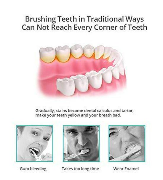 360° U-Shaped Electric Toothbrush - Hands-Free Travel Brush