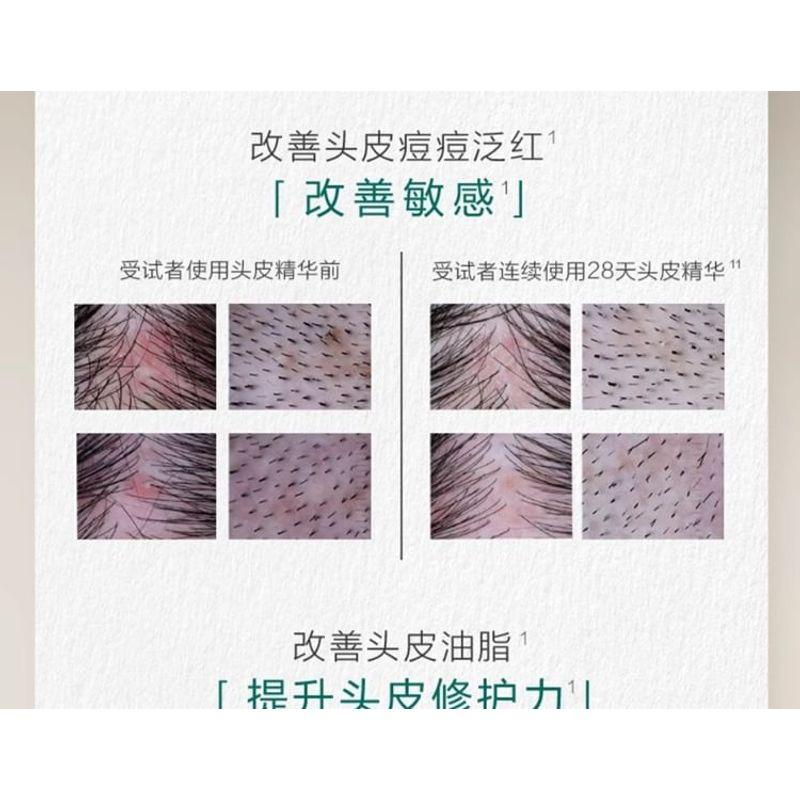 CHANDO - Sensitive Scalp Repair Serum