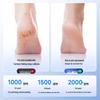High-Efficiency Electric Foot Grinder: Fully Automatic Dead Skin Remover & Heel Exfoliator