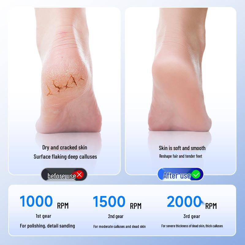 High-Efficiency Electric Foot Grinder: Fully Automatic Dead Skin Remover & Heel Exfoliator