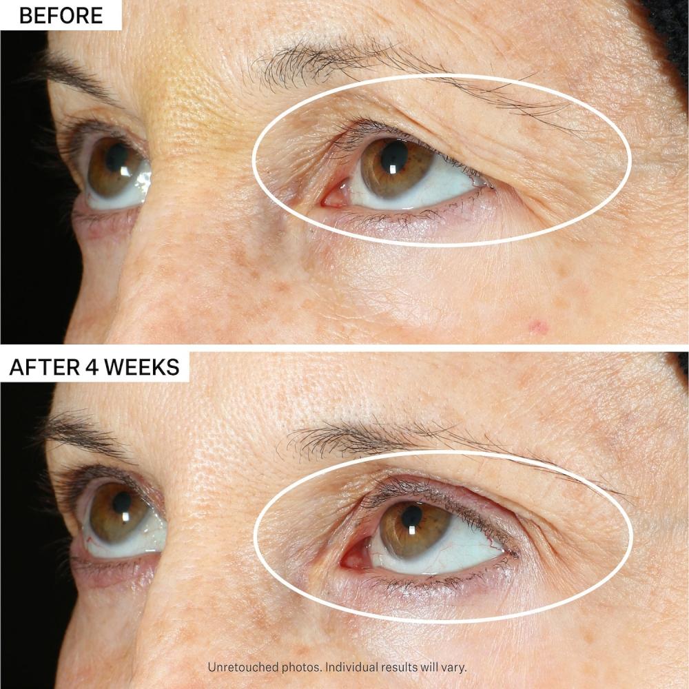 Strivectin Peptight  360  Tightening Eye Serum