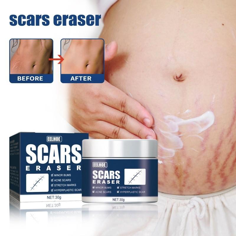 Effective Eelhoe Scar Repair Gel For Reducing Surgical And Burn Scars On Skin