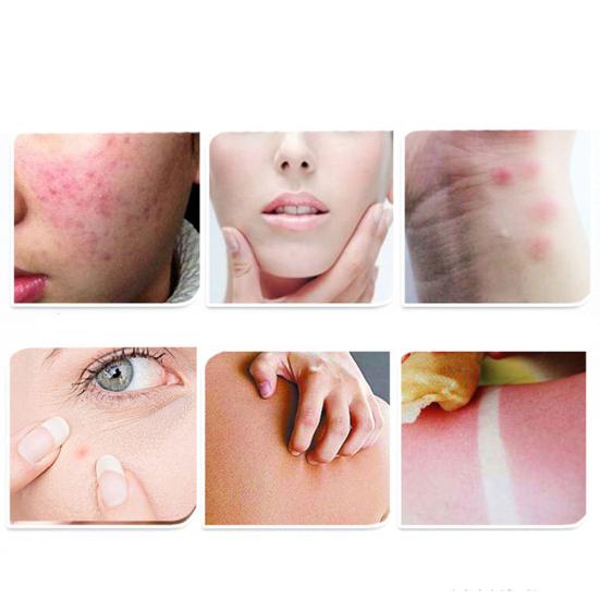 300ml Aloe Vera Gel Hydrating Moisturizing Face Cream Acne Lotion Skin Care
