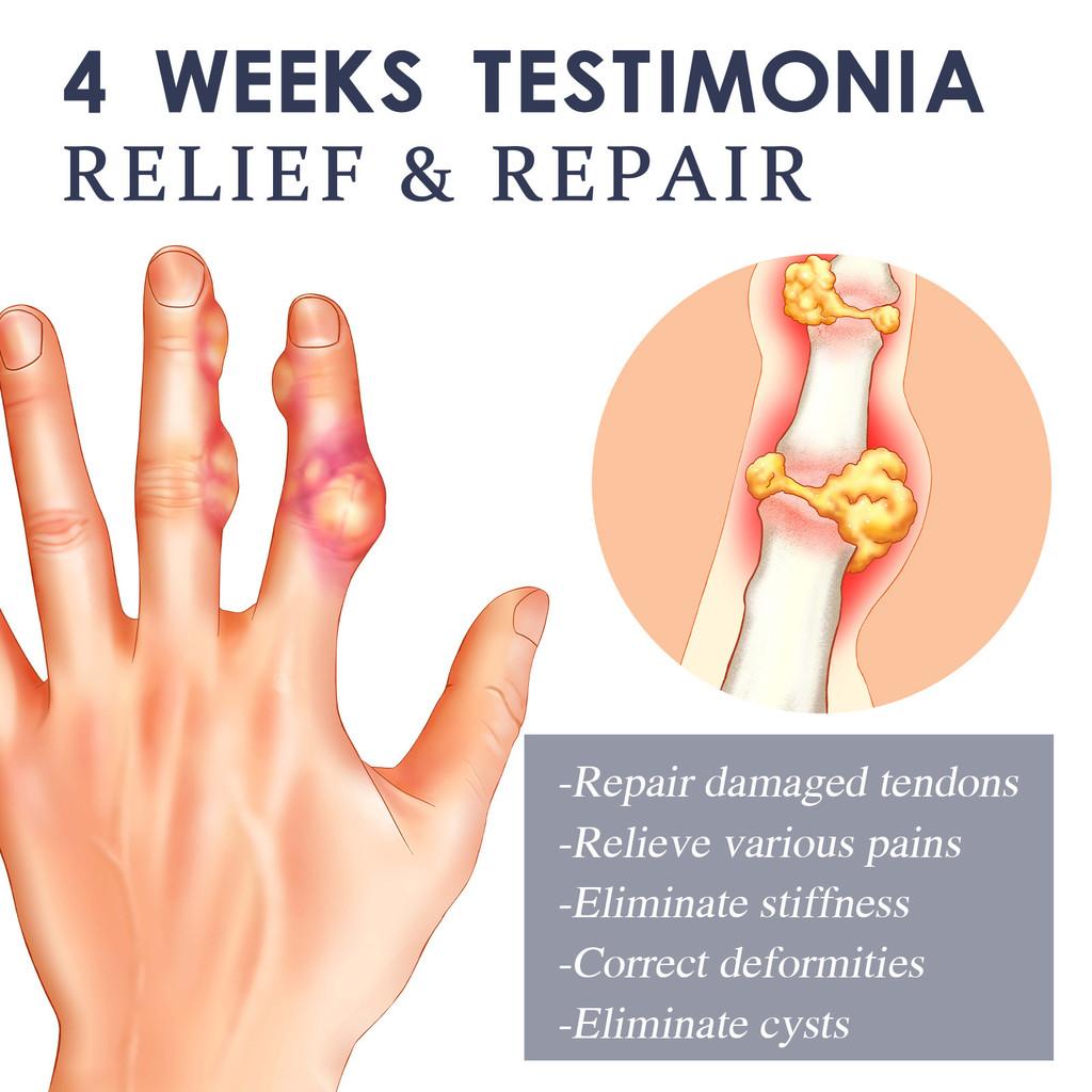 Ximonth Bee Venom Joint Care Cream For Effective Relief From Joint Discomfort And Pain