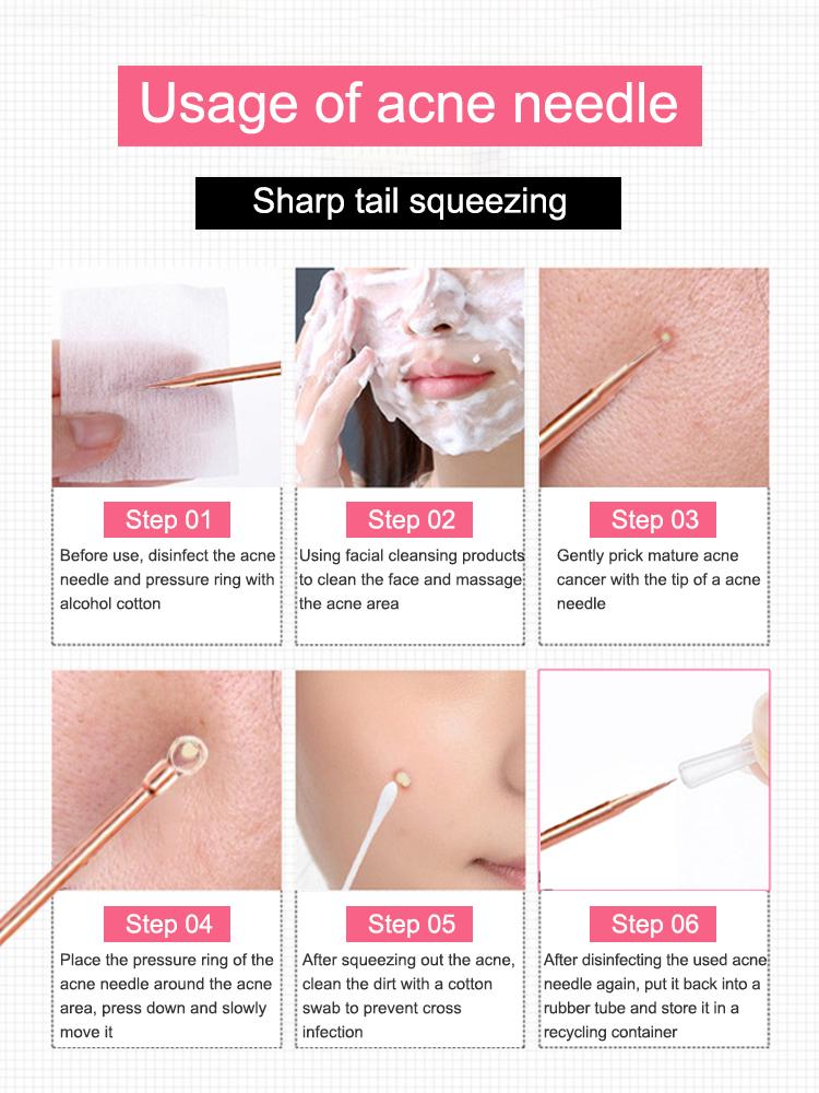 Blackhead Remover Pimple Comedone Extractor Tool Best Acne Removal Kit Treatment for Blemish Whitehead Popping Zit Removing for