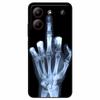 For ZTE Blade A54 4G Case Shockproof TPU Soft Silicone Phone Covers for ZTE Blade A 54 Funda Painted on for BladeA54 Luxury Capa