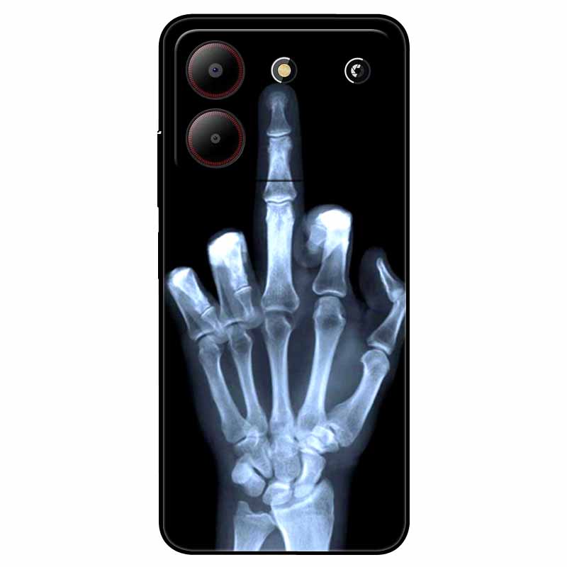 For ZTE Blade A54 4G Case Shockproof TPU Soft Silicone Phone Covers for ZTE Blade A 54 Funda Painted on for BladeA54 Luxury Capa