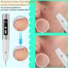 Portable  Removal Instrument Handheld Electric Small   Mole Pen Beauty Salon Instrument