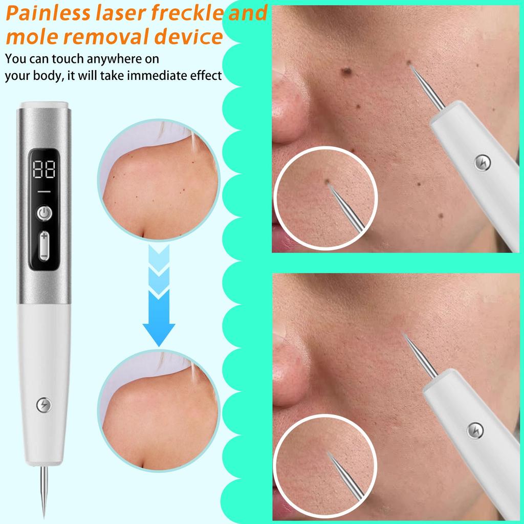 Portable  Removal Instrument Handheld Electric Small   Mole Pen Beauty Salon Instrument