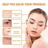 Eelhoe Collagen Eye Mask Spray Set - Anti-Aging, Anti-Wrinkle, Rejuvenating Collagen Hydrating And Moisturizing