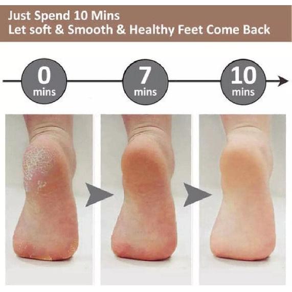 Electric Foot File Hard Skin Remover - Ergonomic Handle Design Foot Callus Remover - Rechargeable Foot File Heel Scraping - Calluses Rubbing 360°
