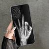 Funny X-Ray Hand Bones Shockproof Phone Case for Samsung A17 A16 A15 A14 A37 A57 A36 A56 A26 A35 A55 A25 A34 A54 A24 A13 A23 A33