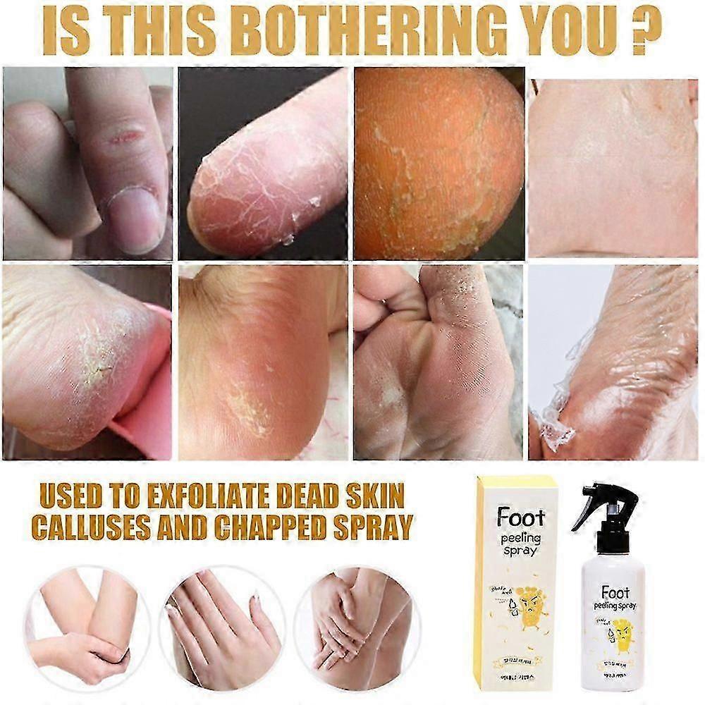 Foot Exfoliation Spray Repair Dead Skin and Calluses Whitening Care Spray