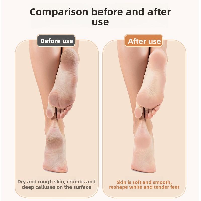 Elektrický pilník na nohy, Pedikúrní artefakt pro odstranění odumřelé kůže a mozolů, Domácí pedikúrní přístroj, Automatický škrabací pilník na nohy