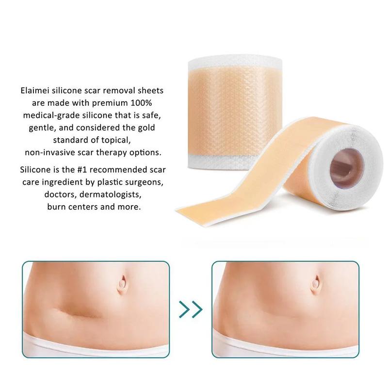 1 Roll Patch Skin Repair Self Adhesive 4X150CM Waterproof Scar Tape Non-slip Scar Sheets Skin Beauty Care Silicone Gel