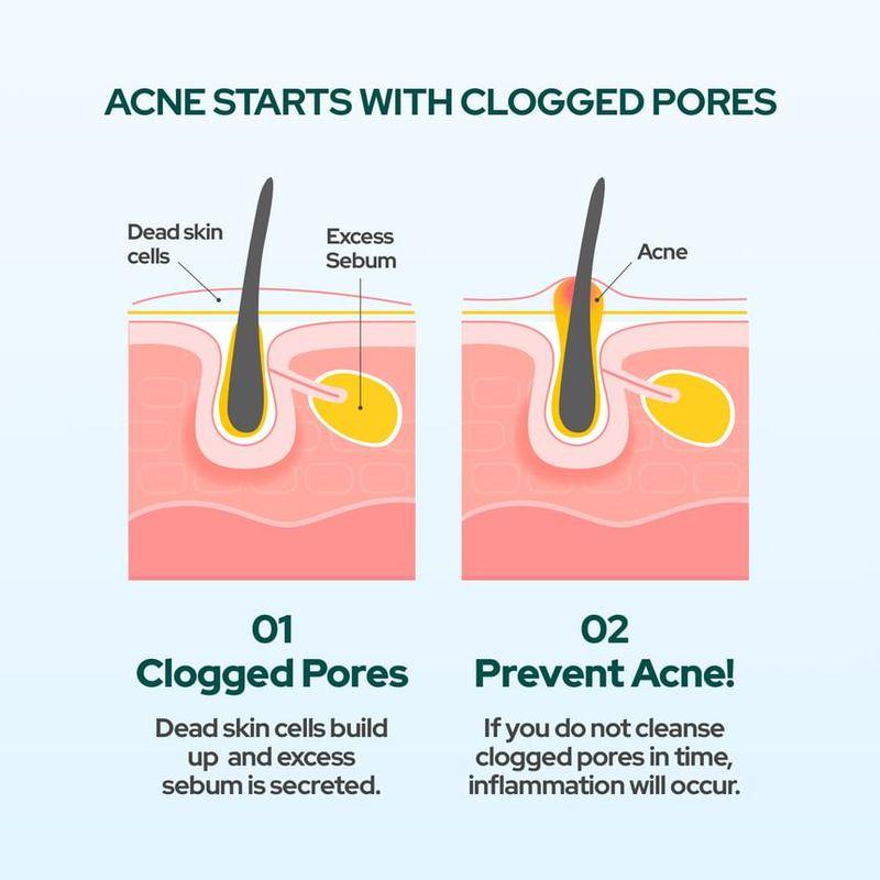THE FACE SHOP - Dr. Belmeur AHA PHA Sebum Control Gel Cleanser