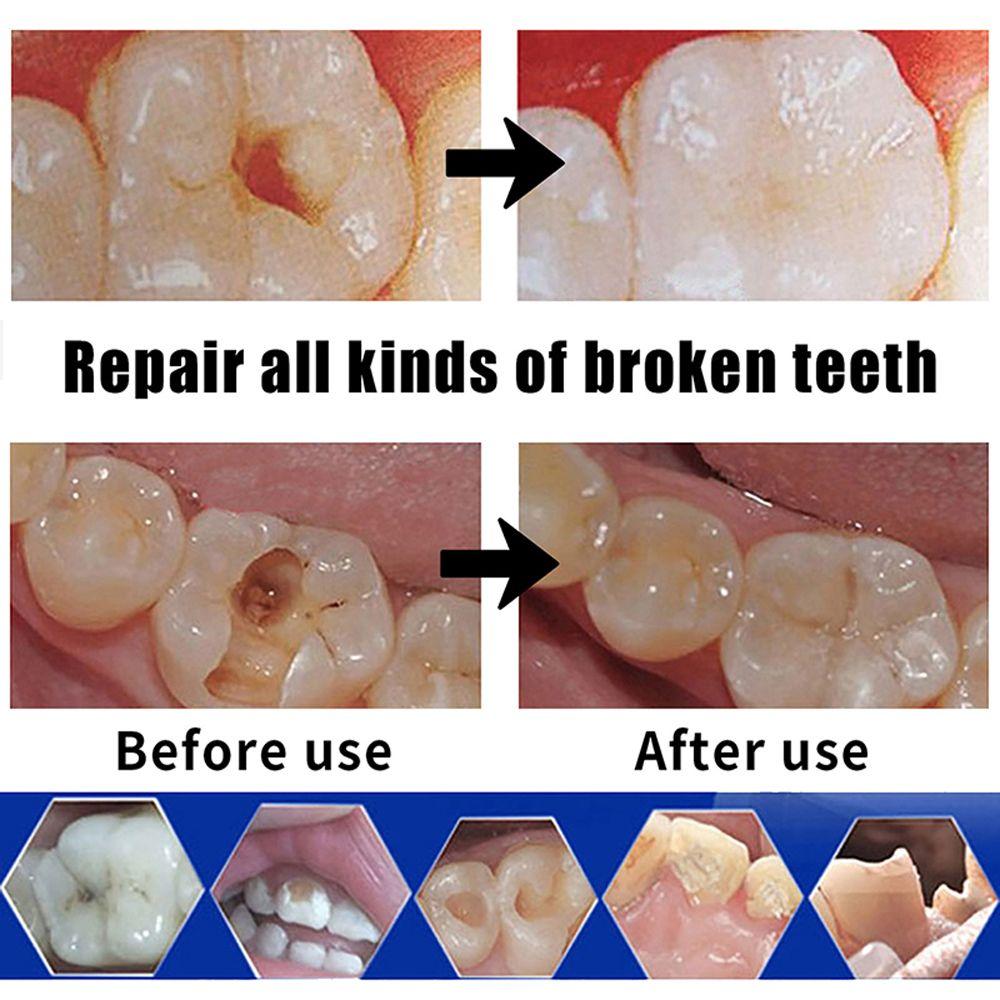 Glue Party Dentures Cosplay Tools Halloween Denture Glue Fake Teeth Glue FalseTooth Gaps Repair Kit