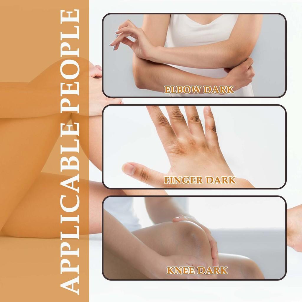 Jaysuing Moisturizing Cream For Joints Hydrating Body Care Lotion For Elbows And Knees