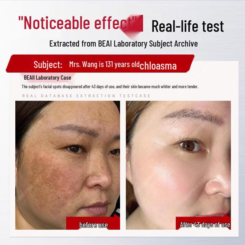 Niacinamide Whitening & Spot Fading Serum