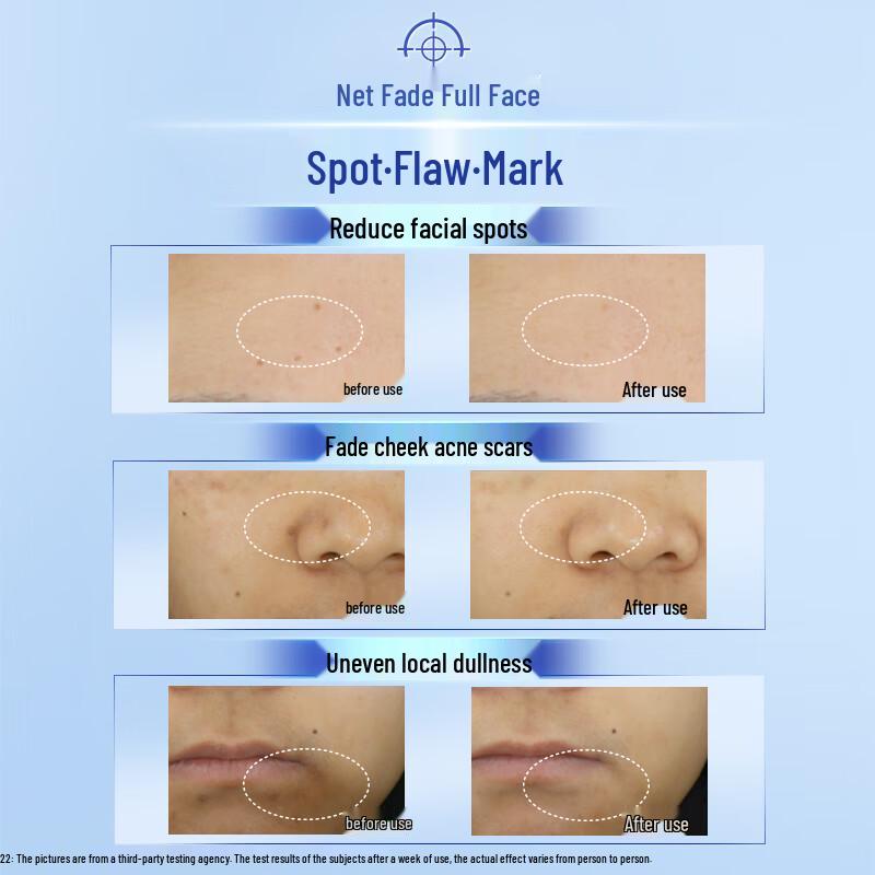 NIVEA LUMINOUS 630 Anti-Spot Whitening Serum 30ml