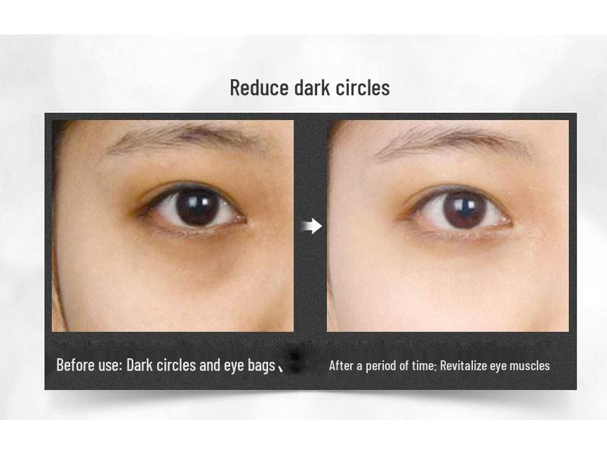 DSM Eye Cream for Dark Circles, Eye Bags, Fine Lines, and Milia - Lifting and Firming Formula