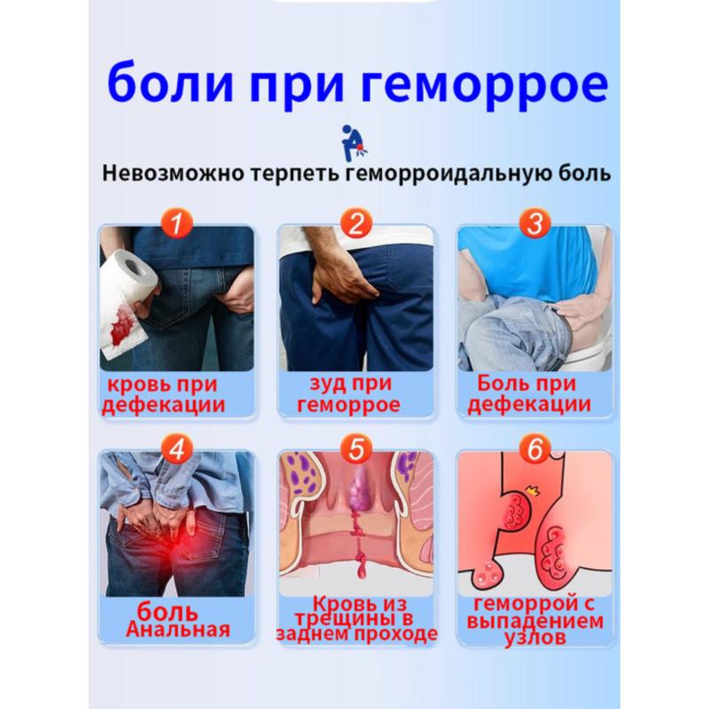 Chinese Hemorrhoid Ointment for Piles and Fissures, 20 Ml