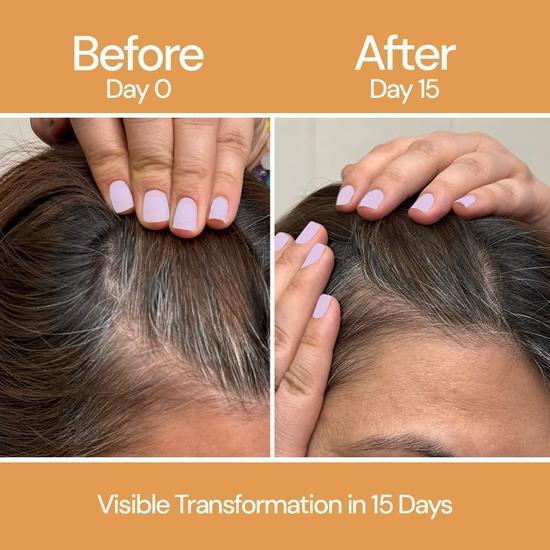 CITTA Hair Growth Serum | Boosts Hair Growth, Activates Follicles & Prevents Thinning | Biotin, Rosemary & Fenugreek Oil | 50ml