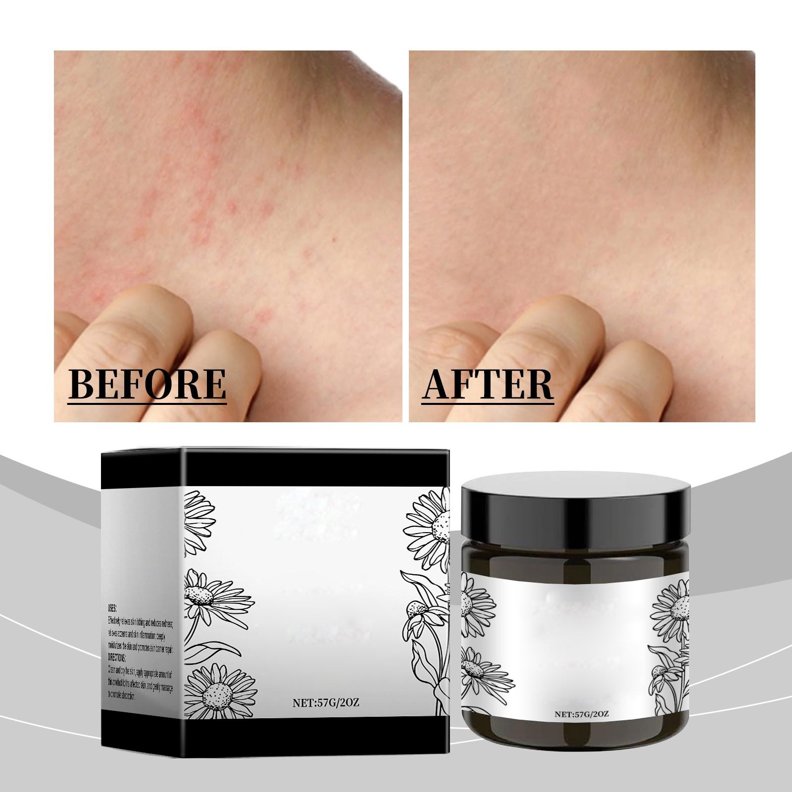 

Многофункциональный крем для ухода снимает экзему и воспаление кожи, глубоко увлажняет кожу и укрепляет ее барьер. One Size